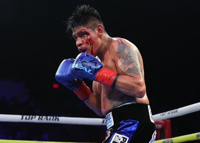Emanuel Navarrete Believes Head-Butt Caused Cut, Wanted To Continue In Fight With Charly Suarez