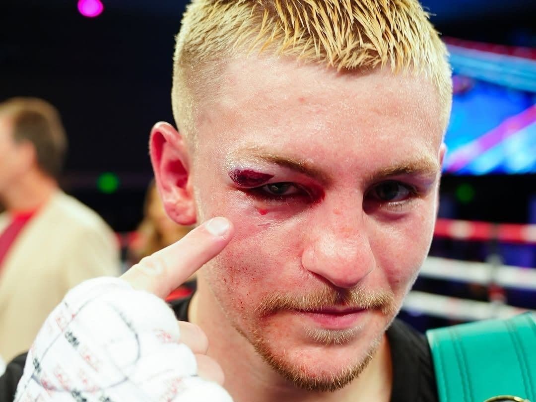 Nasty Eye Gash Sees Callum Walsh Score Fifth-Round Technical Decision Win Against Elias Espadas